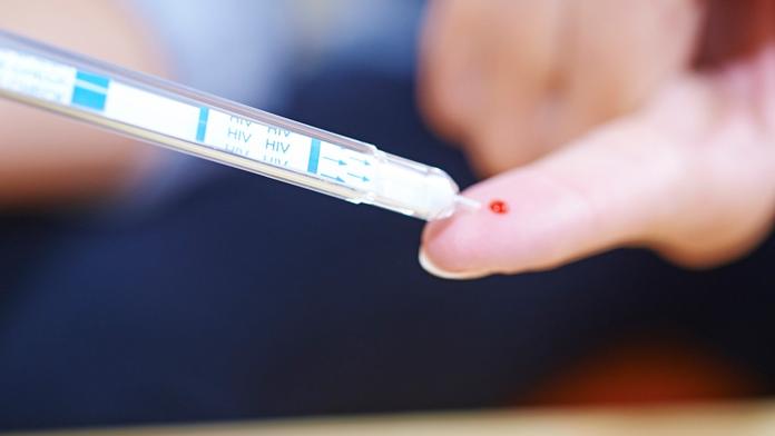 Další záblesk naděje? Moderna spustila testování vakcín proti HIV