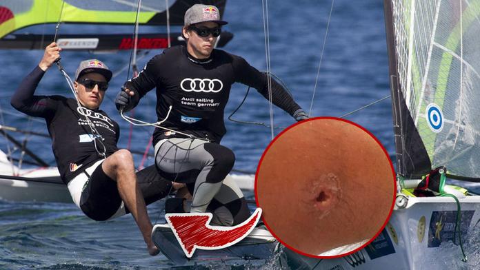 NECHUTNÉ: Tohle způsobila voda jachtaři v olympijském Riu!