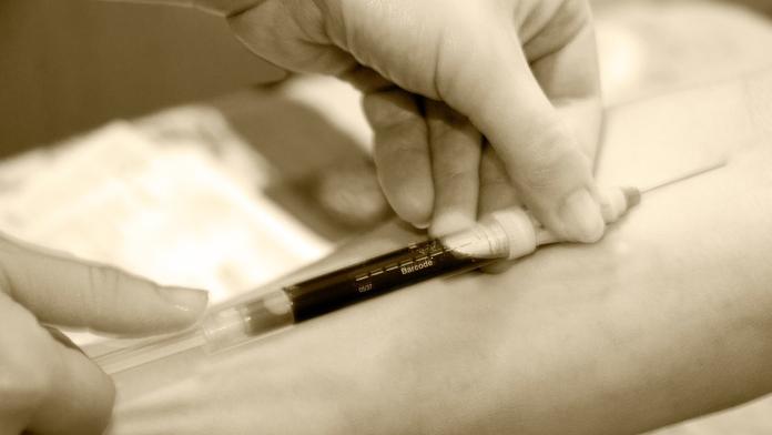 VIRUS HIV STRAŠÍ ČESKO: Tady se můžete otestovat! PŘEHLED