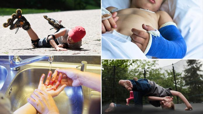 Statistika letních úrazů: Co nejvíc ohrožuje vaše děti