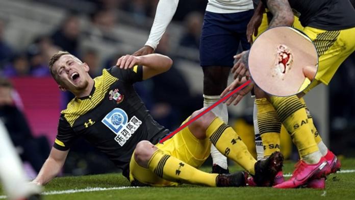 Drsný záběr! Děláš si p***l? Vidíš tu kost?! křičel rozhořčený spoluhráč