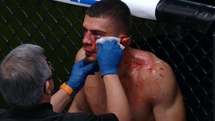 Jen pro otrlé! UFC fighter málem přišel o ucho, rozhodčí musel zápas zastavit