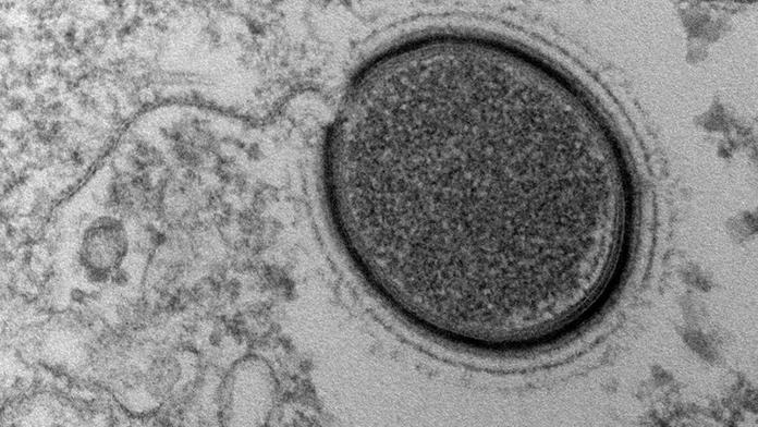 Vědci chtějí oživit obří virus ze Sibiře. Je starý 30 tisíc let!