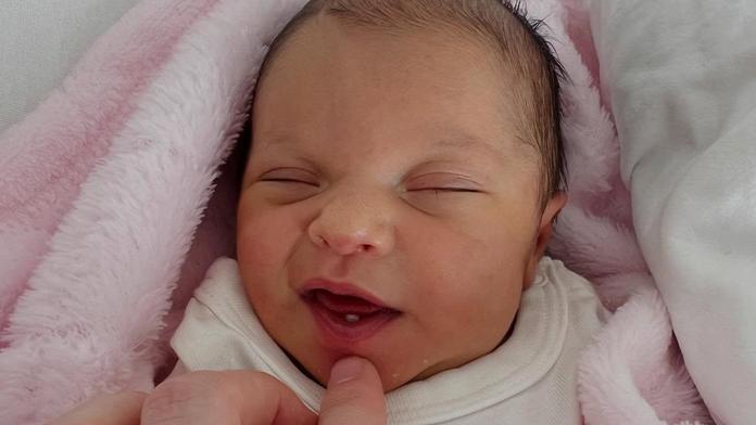 Lékaři jsou v šoku. Na Slovensku se narodilo zubaté miminko