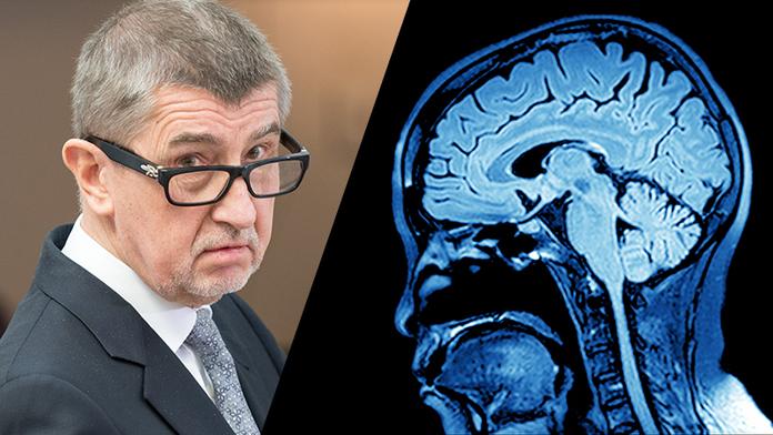 Nemoci Babišových dětí přináší myšlenky na smrt, říká psychiatr