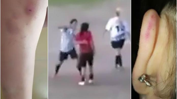 Za faul se pomstila tvrdým loktem! Fotbalistka zůstala ležet VIDEO