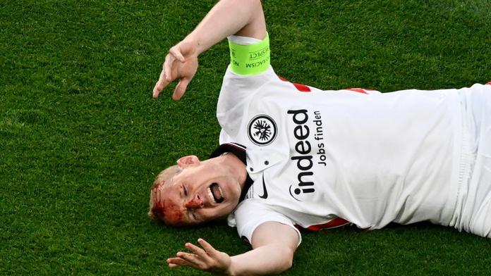 Tohle bez karty? Hráč Rangers soupeři rozkopl hlavu. Vyvázl bez trestu