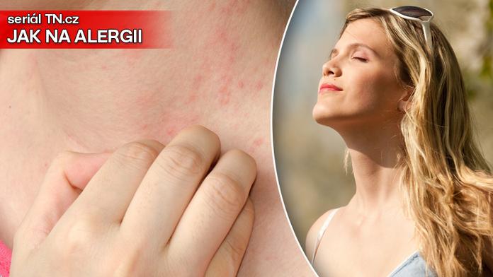Alergie dokáže potrápit i v létě. TIPY jak ji zmírnit