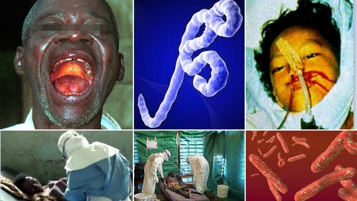 Vše o viru EBOLA: Kde se vzala a jaké má PŘÍZNAKY?