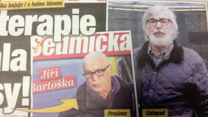 Bartoškův boj s rakovinou: Zatím nezvládne hrát ani v paruce!