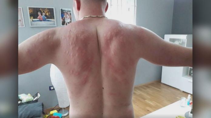 Je to, jako by zmutovali, popisuje muž řádění komárů v Chorvatsku