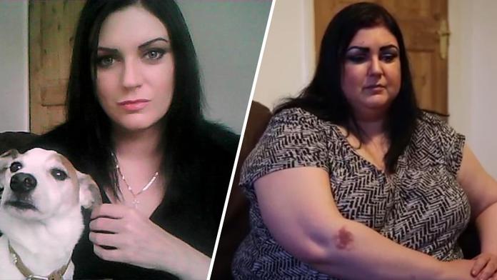 Záhadná nemoc: Krásná Laura se za půl roku proměnila v kouli!