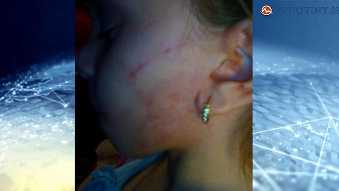 Zubařka ztratila nervy a zfackovala holčičku (6). Takhle dívka dopadla