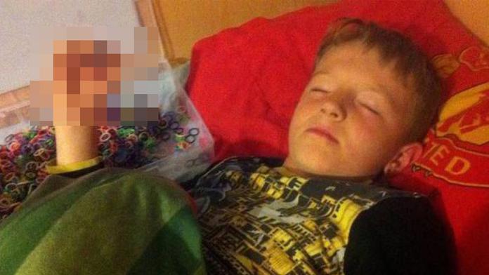 Gumičková závislost: Školák (8) málem přišel o prsty! Foto uvnitř
