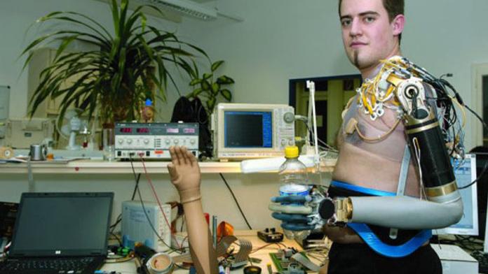 Ruce má jako robot. Protézy řídí myšlenkami