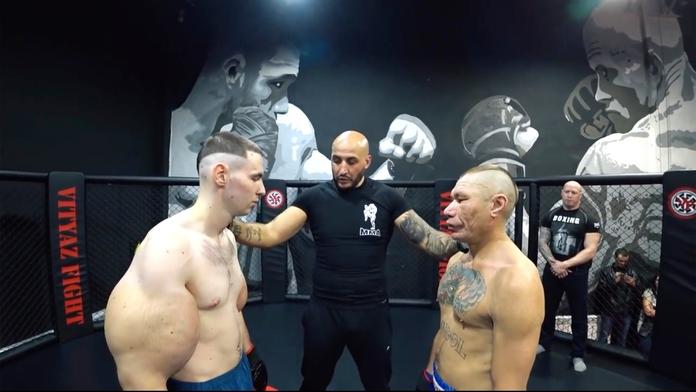 Ruský Pepek přišel o své bicepsy, vytáhli mu z nich 6 litrů vazelíny