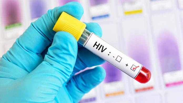 HIV