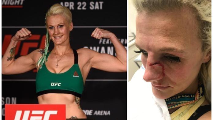 UFC zápasnice se stala obětí domácího násilí. Zmlátil ji expřítel