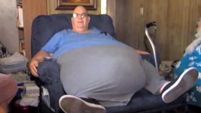 Děsivé! Muži (63) roste z břicha nádor, který váží STO KILO!