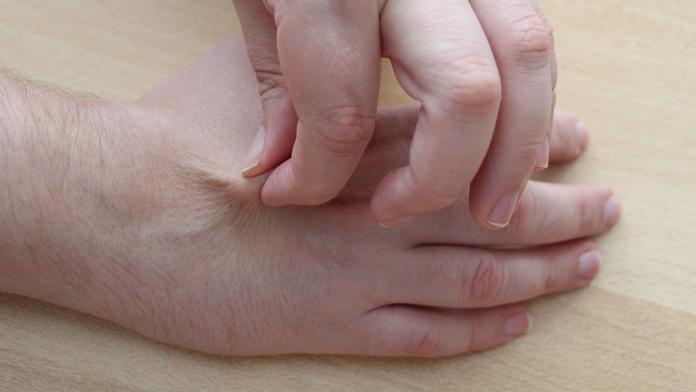 Lékař popisuje snadný test s kůží. Za pár vteřin může odhalit dehydrataci