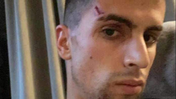 Hvězdný fotbalista Manchesteru byl přepaden u sebe doma, utrpěl i zranění