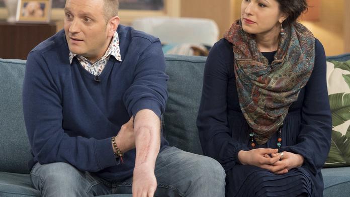 Brit (45) měl poprvé sex díky bionickému penisu! Popsal zážitky