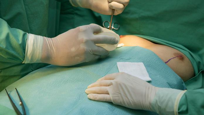 Andree zkazil lékař prsa! Praskly jí stehy a implantáty čouhaly ven