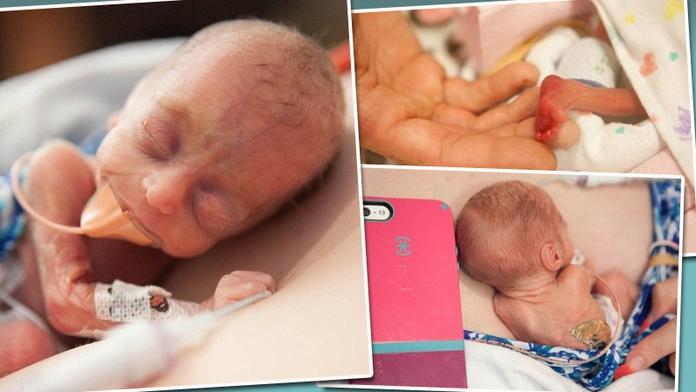 Ženě umřelo předčasně narozené dítě, tak začala fotit ostatní