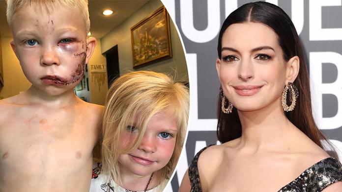 Hrdina (6) uchránil svou sestričku před psem. Celebrity mu vzdaly hold