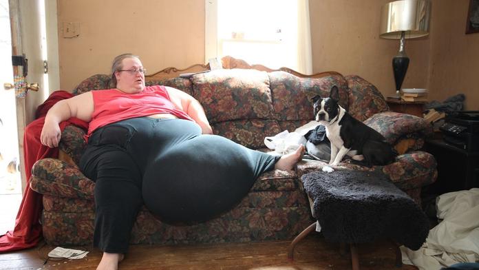 Unikátní operace! Lékaři ženě odřízli nádor vážící 50 kilo! FOTKY
