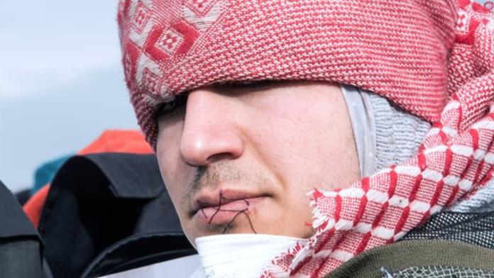 Bourání tábora v Calais: Uprchlíci protestují SEŠITÝMI ÚSTY