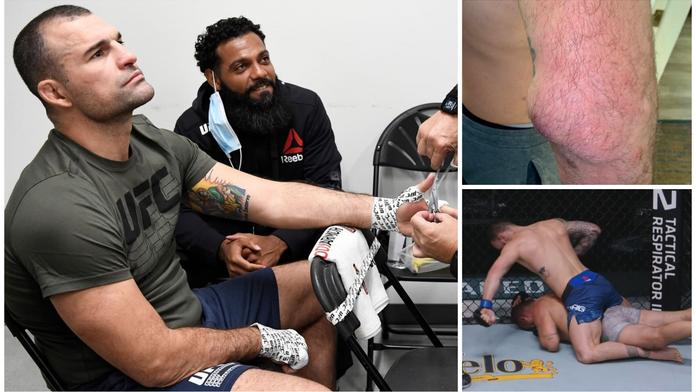 To musí bolet! UFC veterán po prohře odhalil ošklivé zranění
