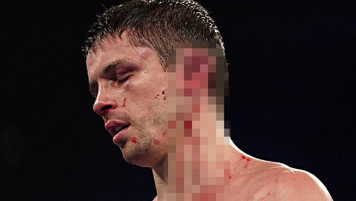 Soupeř rozpůlil Smithovi ucho. Takhle vypadá boxer dnes! FOTO
