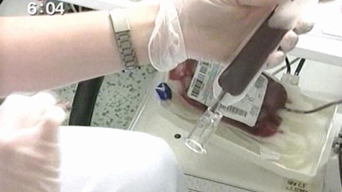 Alzheimerovu chorobu pomůže odhalit jednoduchý krevní test