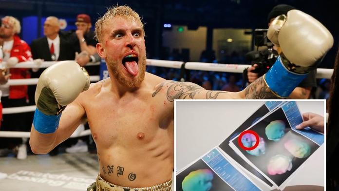 Slavný youtuber v ringu riskuje: Mám poraněný mozek, říká Jake Paul