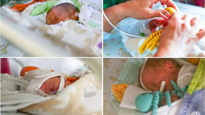 V pražském Motole se narodila čtyřčata! První po 15 letech