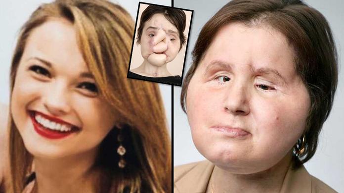 Dostala druhou šanci! Kráska se střelila do obličeje, už má nový
