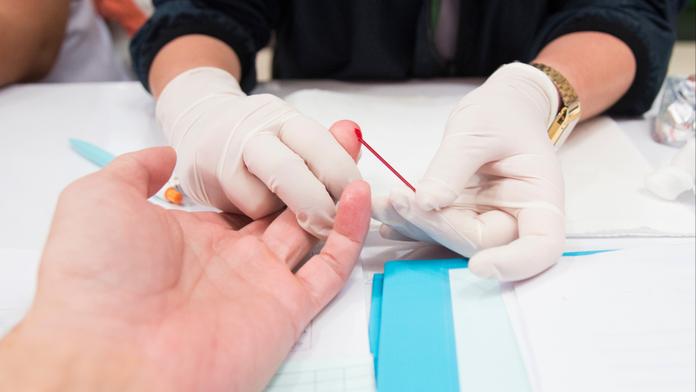 Naděje pro nemocné! Lékaři vyléčili dalšího pacienta nakaženého virem HIV