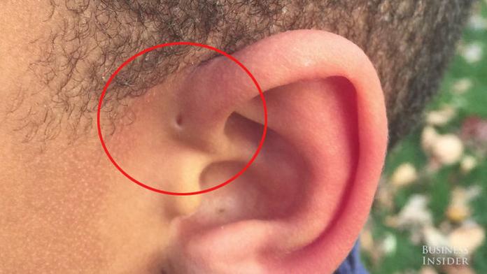 Někteří lidé se narodili s dírkou na uchu. Biolog odhalil proč