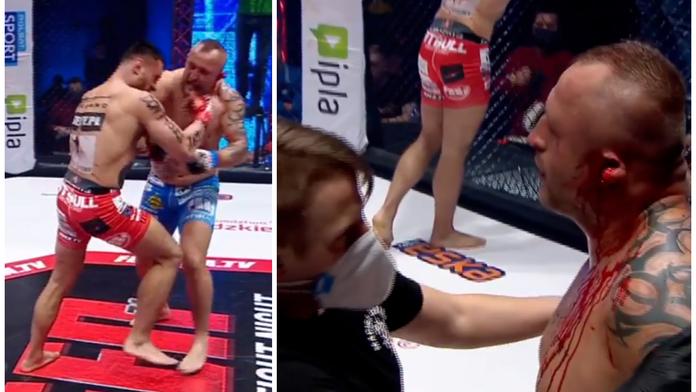 VIDEO jen pro otrlé! Nechybělo málo a MMA zápasník přišel o ucho
