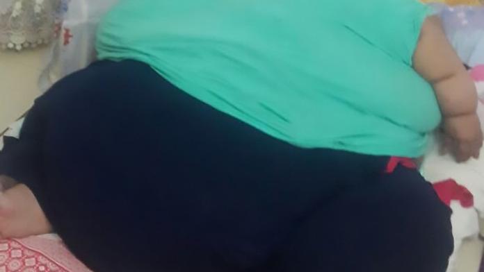 Extrémní nadváha: Žena váží půl tuny! Z domu už nevyšla 25 let