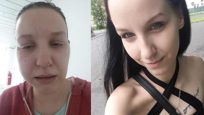 Žena řeší zničené zuby s klinikou, na hororového zubaře podala stížnost