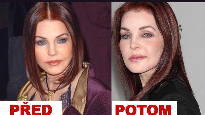 Zpackaná plastika. Priscilla Presley vypadá hrozně