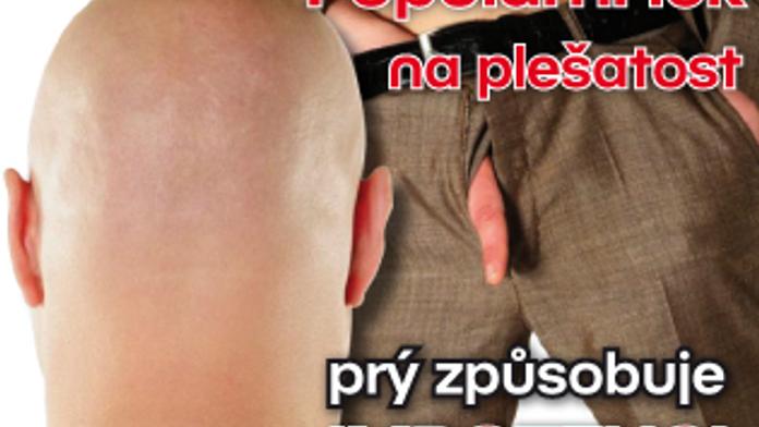 Populární lék na plešatost prý způsobuje IMPOTENCI