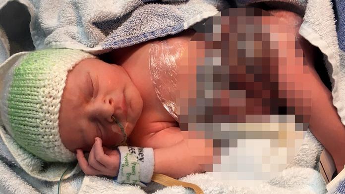 Holčička se narodila bez bříška! Lékařům se podařilo nemožné