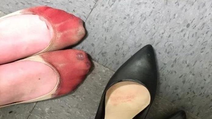 Krvavé nohy po celodenní práci! Komu patří zničená chodidla?