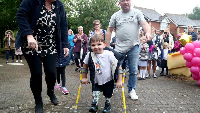 Tony (5) kvůli týrání přišel o nohy. Zachráncům věnoval krásné gesto