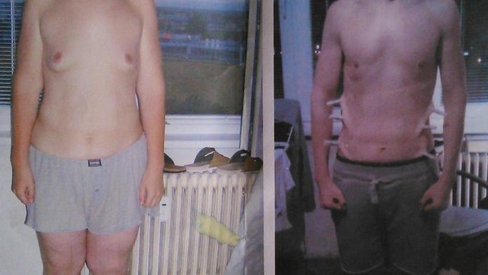 Michal (19) už měl velké poprsí! Zhubl 90 kilo a je z něj sexy kluk