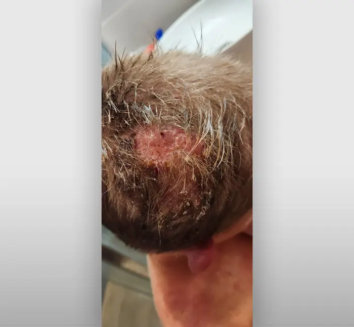 Projev dermatofytózy ve vlasech