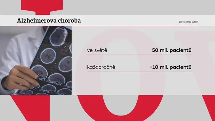 Alzheimerova choroba